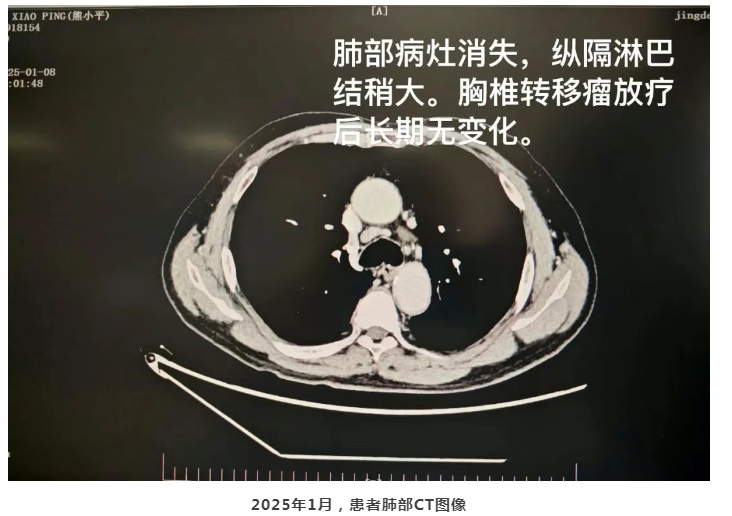 微信截图_20250418084240.png