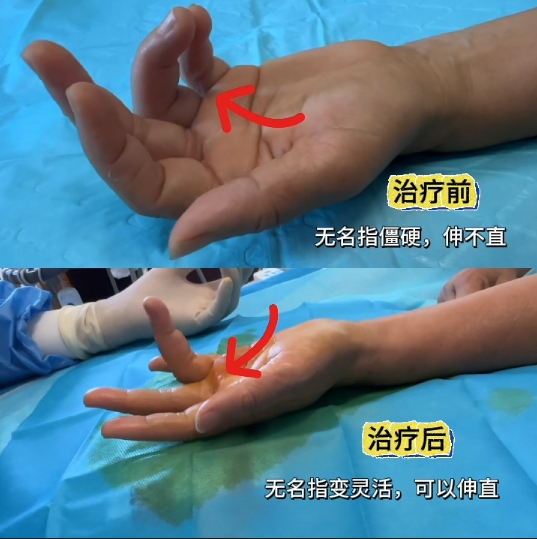 微信截图_20250626083812.png